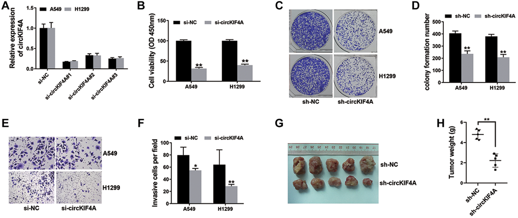 Knockdown of circKIF4A suppresses NSCLC cell proliferation and metastasis (*P **P  (A) siRNAs were used to knockdown circKIF4A expression. (B) CCK-8 assay was performed to investigate cell proliferation ability. (C) Colony formation assay was conducted to reveal cell colony-forming ability. (D) Barplot drawn by ImageJ. (E) The result of transwell assay. (F) Barplot drawn by ImageJ. (G) Mouse xenograft models were used to evaluate circKIF4A function in vivo. (H) Result of xenograft tumor weights.