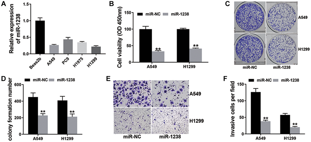 miR-1238 suppresses NSCLC cell proliferation and metastasis (**P  (A) qRT-PCR detected miR-1238 expression in NSCLC cell lines. (B) CCK-8 assay was performed to investigate cell proliferation ability. (C) Colony formation assay was conducted to reveal cell colony-forming ability. (D) Barplot drawn by ImageJ. (E) Transwell assay was performed to detect cell metastasis. (F) Barplot drawn by ImageJ.