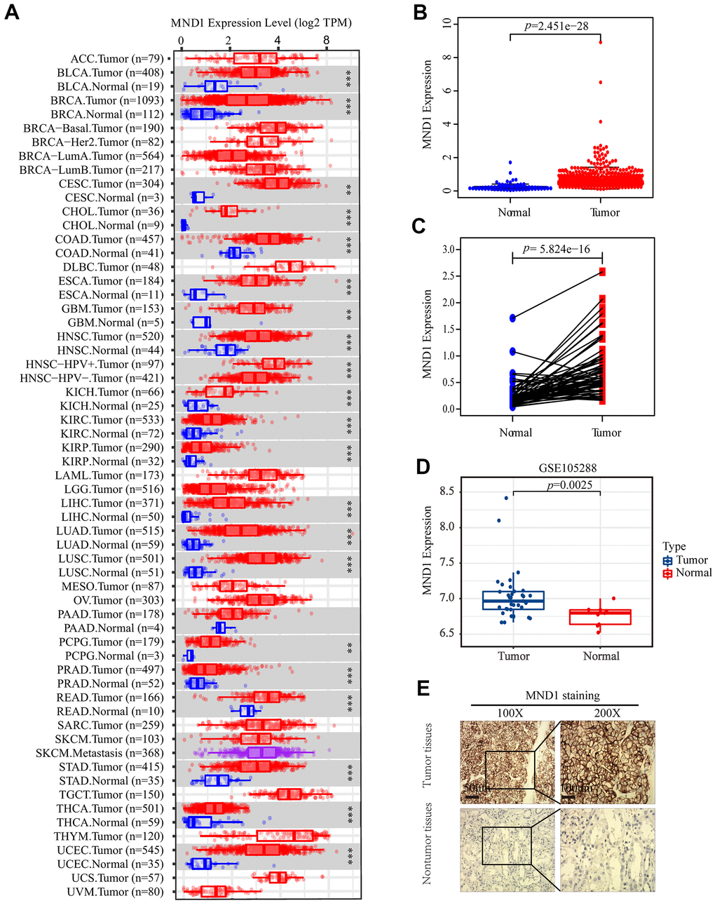 The expression of MND1 in different datasets. (A) The mRNA level of MND1 in 33 kinds of tumor types from TIMER. (**pB) Expression levels of MND1 were higher than non-tumor tissues in KIRC samples(p=2.451e-28). (C) MND1 expression of KIRC tissues and corresponding normal tissues downloaded from TCGA RNA-seq datasets(p=5.824e-16). (D) MND1 expression is significantly regulated in KIRC in the GSE105288. (E) Typical images of IHC in 30 pairs of KIRC tissues showing the protein expression of MND1 in KIRC and adjacent nontumor tissues.