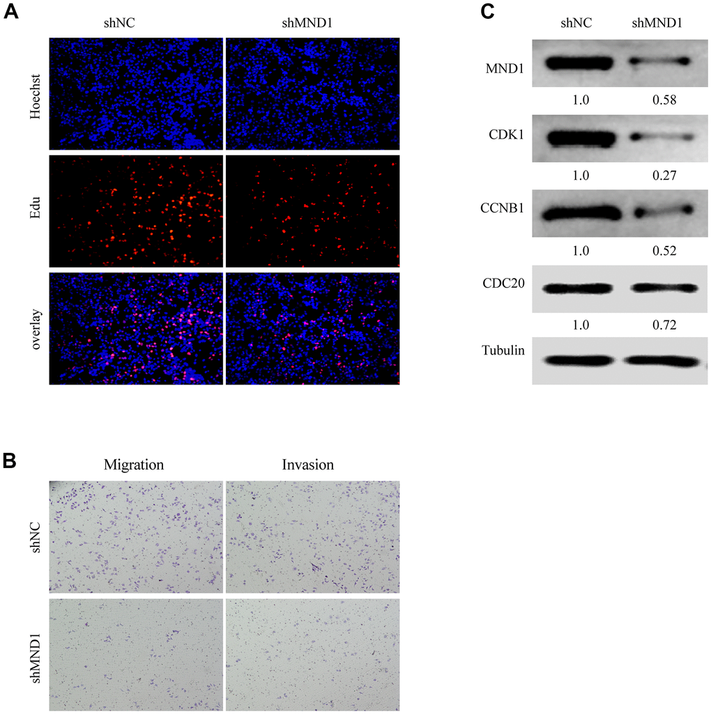 MND1 promotes proliferation and migration of KIRC in vitro. (A) Proliferation capacity for KIRC cells treated with shMND1 or shNC was detected by EdU and cell clone formation assays. (B) Migration and invasion capacity for KIRC cells treated with shMND1 or shNC was detected by Transwell separately. (C) The result of Western blot showed the protein expression of CDK1, CDC20, and CCNB1 was interfered with MND1.