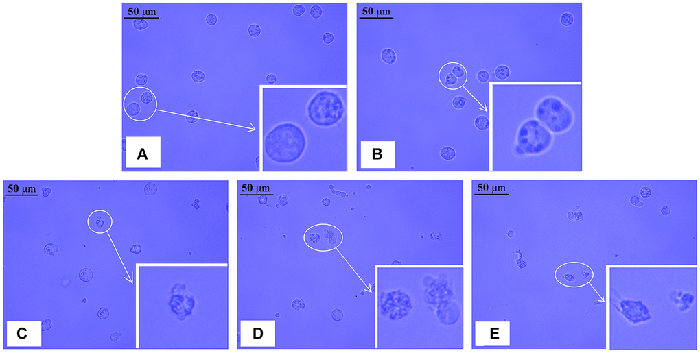 Morphological changes in NB4 cells after exposure to different concentrations of realgar for 24 h. The cells were treated with different concentrations of realgar for 24 h, and typical images were captured by a light field microscope. (A) Control cells; (B) cells exposed to 12.5 μg/ml of realgar; (C) cells exposed to 25.0 μg/ml of realgar; (D) cells exposed to 50.0 μg/ml of realgar; and (E) cells exposed to 75.0 μg/ml of realgar. Inset, magnified cells.