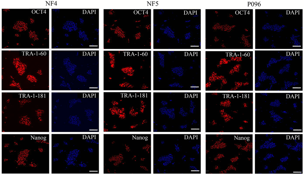 Immunofluorescence staining. The expressions of OCT4, Nanog, TRA-1-60 and TRA-1-181 in hESCs were detected through immunofluorescence staining. The scale bar was 100 μm.