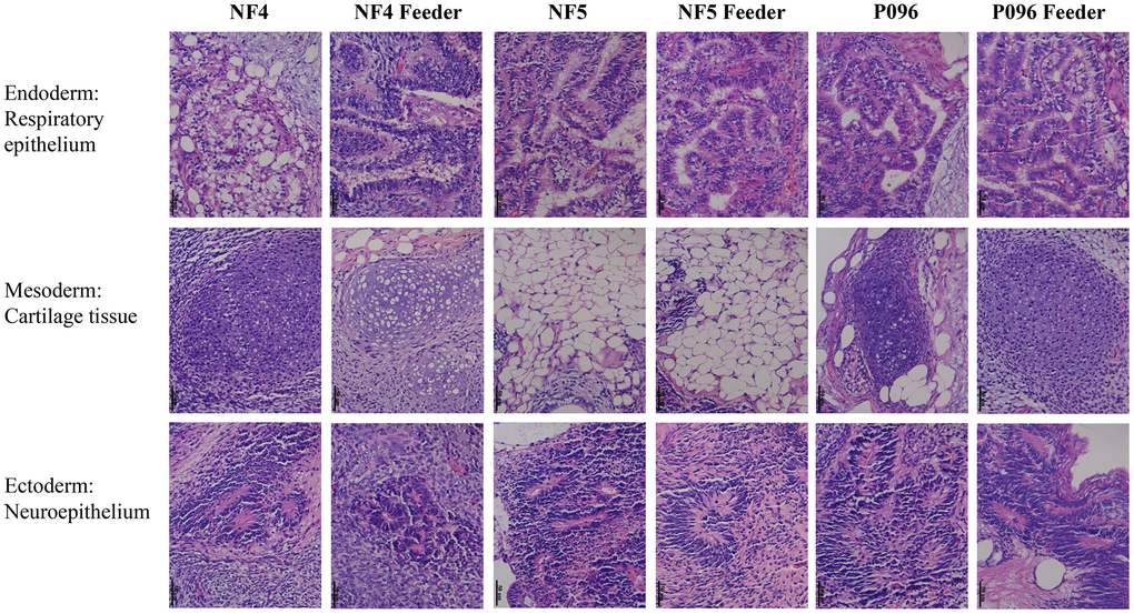 Teratomas containing derivatives of all the 3 germ layers. Histological evidence of germ layer differentiation in NF4, NF5 and P096 in the feeder-free culture system or on HFF feeder layers. A typical teratoma containing endoderm (respiratory epithelium), mesoderm (cartilage tissue) and ectoderm (neuroepithelium). Magnification was 400× in total.