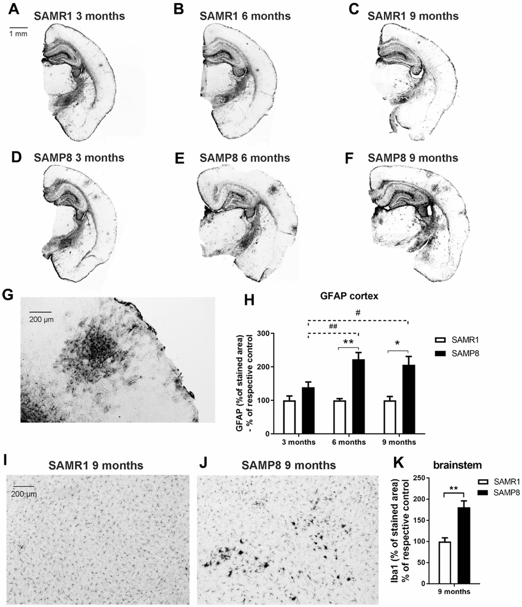 Increased neuroinflammation in the brains of SAMP8 mice: (A–G) marker of reactive astrocytes GFAP in the cortex, and (H) its quantification, and (I, J) marker of microglia Iba1 in the brainstem and (K) its quantification. Data are mean ± SEM, analyzed by 2-way ANOVA with Bonferroni post test (GFAP) or t-test (Iba1). Significance is *P 