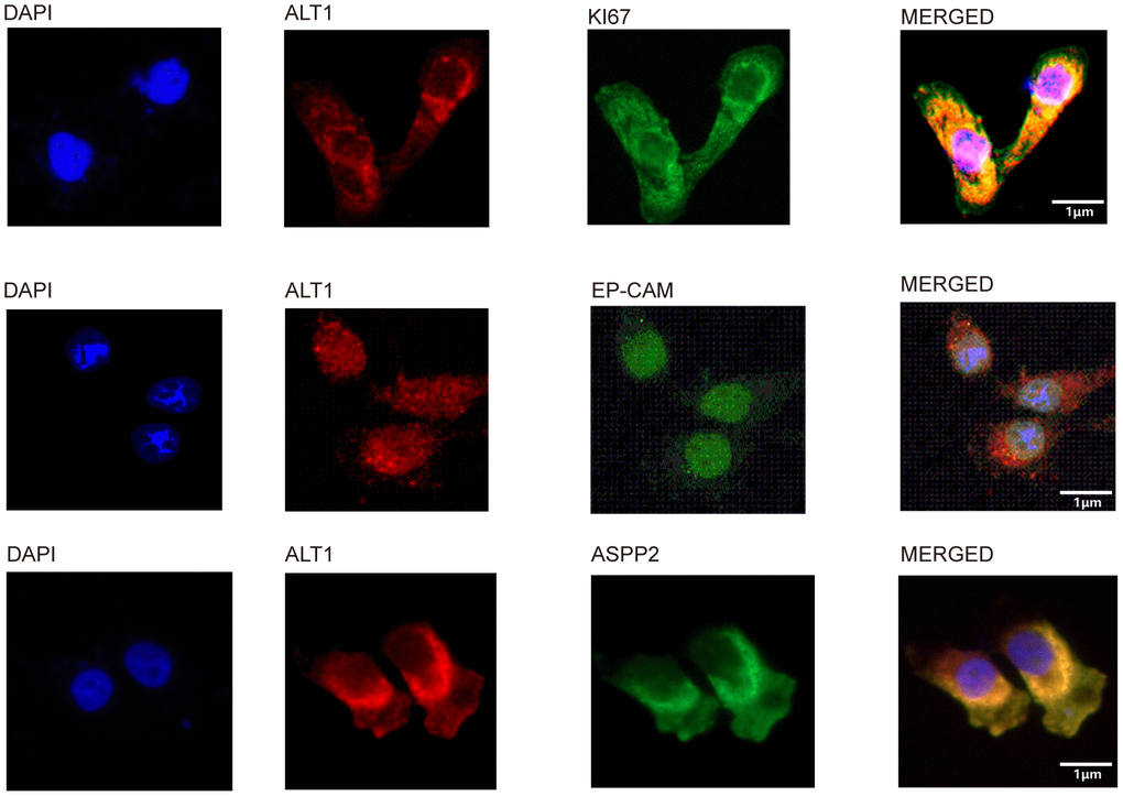 Co-localization of ALT1 and ALT1-binding proteins.