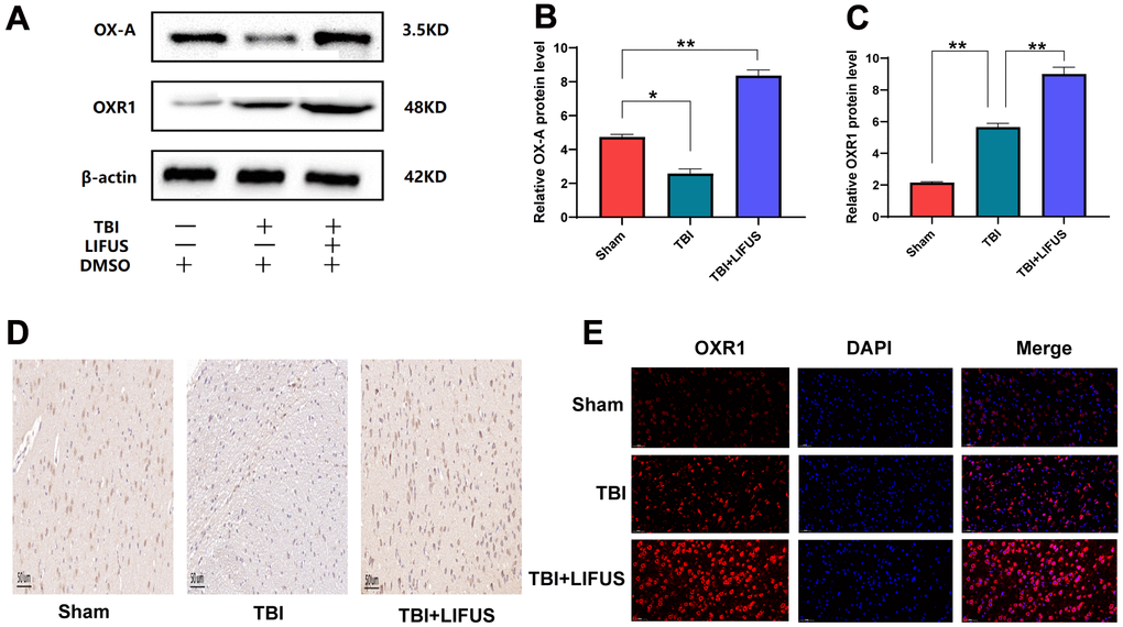 Low-intensity focused ultrasound (LIFUS) can increase the expression of orexin-A (OX-A) and orexin receptor 1 (OXR1) in traumatic brain injury (TBI) rat brain tissue. (A) OX-A and OXR1 represent western blot protein bands. (B, C) represents the gray values of the OX-A and OXR1 bands, respectively. (D) Representative immunohistochemical staining and relative protein expression of OX-A. (positive expression was brownish yellow. Scale=50 um). (E) OXR1 representative immunofluorescence staining. (OXR1 staining is red, and all nuclear DAPI staining is blue. Scale=50 um). Results are expressed as mean±standard deviation (n=6, SD, *P