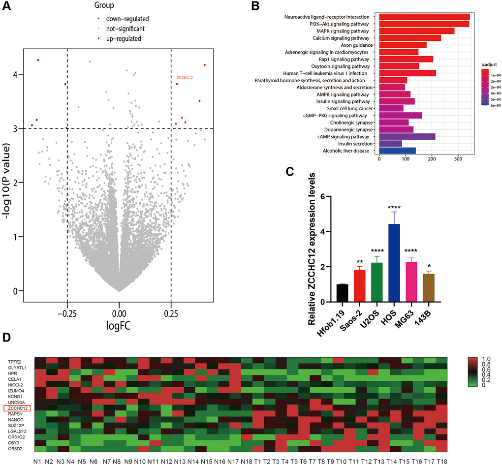 ZCCHC12 was upregulated in OS. (A) Differences in gene expression between OS and normal bone tissues represented by a volcano plot. (B) KEGG enrichment analysis indicated that PI3K/AKT signaling pathways had been significantly altered. (C) ZCCHC12 expression was detected in OS cell lines by qRT-PCR. (D) Heatmap of differential gene expression in OS and normal bone tissues. n = 5; *P **P ***P ****P 