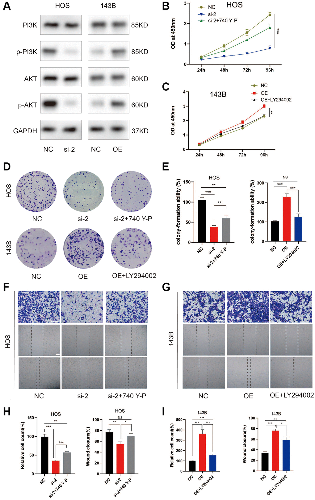 ZCCHC12 contributed to OS progression through PI3K/AKT signaling pathway. (A) The expression levels of PI3K/AKT signaling pathway-associated proteins were detected by western blot analysis. (B–I) functional rescue experiments using PI3K agonist 740Y-P or PI3K inhibitor LY294002 were performed to verify the effect of ZCCHC12 on proliferation and migration in OS. ZCCHC12-silenced HOS cells were treated with 740 Y-P while ZCCHC12-overexpressed 143B cells were treated with LY294002, then cells were used for proliferation analysis (B and C), CCK-assays; (D and E), colony formation assays) and migration analysis (F–I), Transwell migration assays and wound-healing assays). scale bar: 200 μm. n = 5; *P **P ***P 