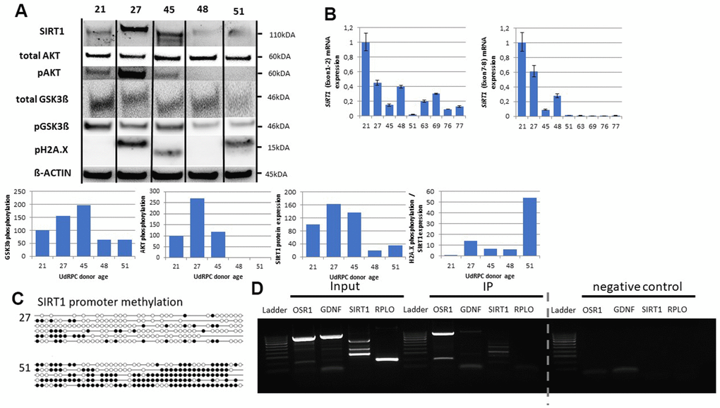 SIX2/SIRT1/AKT/GSK3β network is altered in UdRPCs derived from aged donors. Relative protein expression normalized to ß-ACTIN for SIRT1, AKT and GSK3ß and relative protein phosphorylation for AKT, GSK3β and pH2A.X was detected by Western blot (A). mRNA expression of SIRT1 was determined by quantitative real time PCR (B). Detailed analyses by bisulfite sequencing of CpG island methylation patterns within 5′ regulatory region of SIRT1 gene in young and aged UdRPCs (C). SIX2 binding within the SIRT1 gene was confirmed by Immunoprecipitation followed by PCR analysis (D). The grey dashed line indicates that gel picture has been merged (for the original gel picture see Supplementary Figure 6).