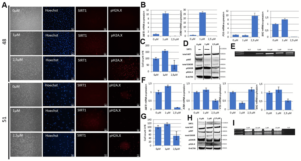 The SIX2/SIRT1/AKT/GSK3β network can be activated by resveratrol and regulates the cell fate of UdRPCs. Cell culture medium of UdRPCs was supplemented with different concentrations of resveratrol for 24h. Activation of SIRT1 and phosphorylation of H2A.X were monitored by immunofluorescence-based detection (A) (scale bars: 100 μm). mRNA expression of SIRT1, ATM, P16 and SIX2 was determined in U48 by quantitative real-time PCR (B). Cell growth of U48 was evaluated after 24h of resveratrol treatment as depicted (C). Relative protein expression normalized to ß-ACTIN for SIRT1, AKT and GSK3ß and relative protein phosphorylation for AKT, GSK3ß and pH2A.X in U48 was detected by Western blot (D). RT-PCR analysis reveal Progerin transcripts in U48 treated with high concentrations of resveratrol (E). mRNA expression of SIRT1, ATM, P16 and SIX2 was determined in U51 by quantitative real-time PCR (F). Cell growth of U51 was evaluated after 24h of resveratrol treatment as depicted (G). Relative protein expression normalized to ß-ACTIN for SIRT1, AKT and GSK3ß and relative protein phosphorylation for AKT, GSK3ß and pH2A.X in U51 was detected by Western blot (H). RT-PCR analysis reveal Progerin transcripts in U51 treated with high concentrations of resveratrol (I).