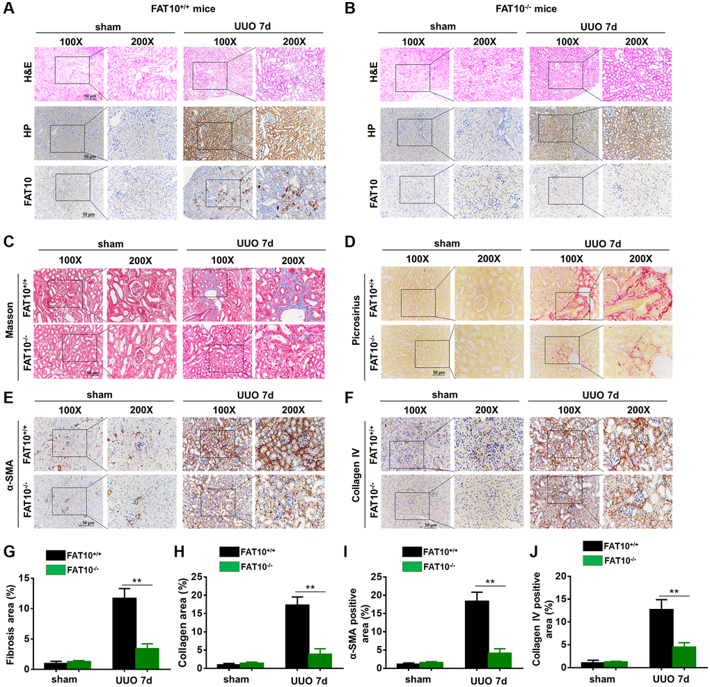 UUO-induced kidney fibrosis was suppressed in FAT10-deficient mice. (A and B) Representative HP and FAT10 staining in the kidneys from FAT10+/+ (A) and FAT10−/− (B) mice subjected to either UUO or sham operation; scale bar = 50 μm. (C and D) Representative Masson’s trichrome (C) and picrosirius red staining (D) of kidney sections from FAT10+/+ and FAT10−/− mice with or without UUO for 7 days. (E and F) Immunohistochemistry of protein expression of α-SMA (E) and Collagen IV (F) in obstructed kidneys from FAT10+/+ and FAT10−/− mice subjected to either UUO or sham operation. (G and H) Bar graph (right) shows quantification of fibrotic areas in histological sections; **P +/+ mice at the same time point; n = 6. (I and J) Bar graph shows quantification of areas of positive cells; **P +/+ mice at the same time point; n = 6.