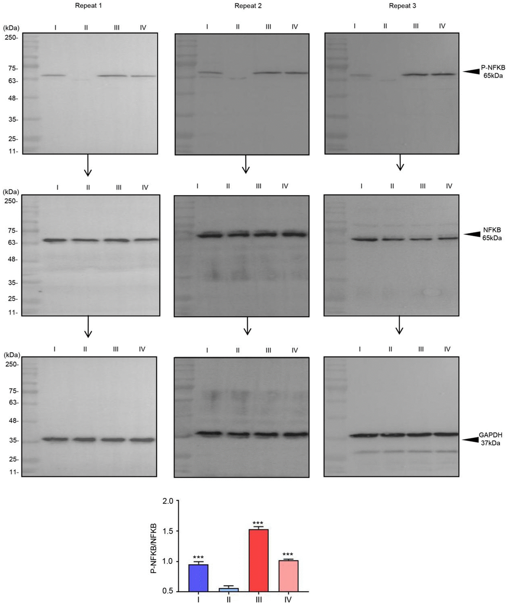 The phosphorylation of NFKB in urine sample. Phosphorylation of NFKB in urine sample regulated by radiotherapy. The relative intensity of P-NFKB was compared with NFKB. ***p