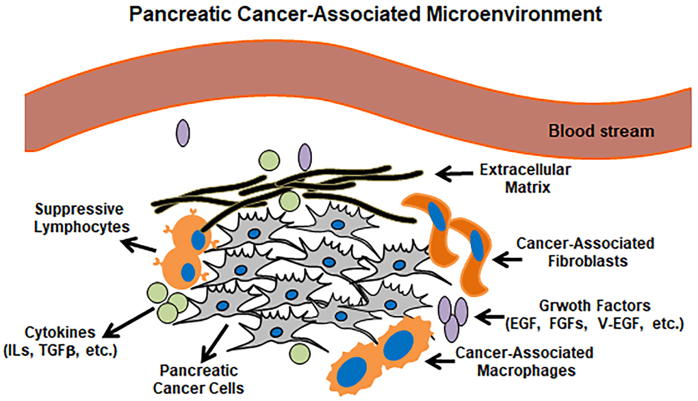 Pancreatic cancer microenvironment. Pancreatic cancer lesions mainly include pancreatic cancer cells, suppressive lymphocytes, cancer-associated macrophages/fibroblasts and cancer-related cytokines/growth factors.