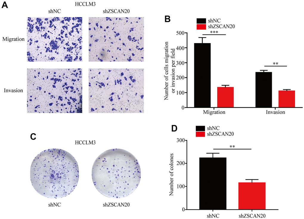 Transwell and colony formation assays. (A, B) Migration and invasion capacity for HCC cells treated with shZSCAN20 or shNC was detected by Transwell separately. **p C, D) Colonies formed by HCCLM3 cells transfected with control shRNA or shRNA targeting ZSCAN20. The right panels are quantification of the results of the colony formation assay.