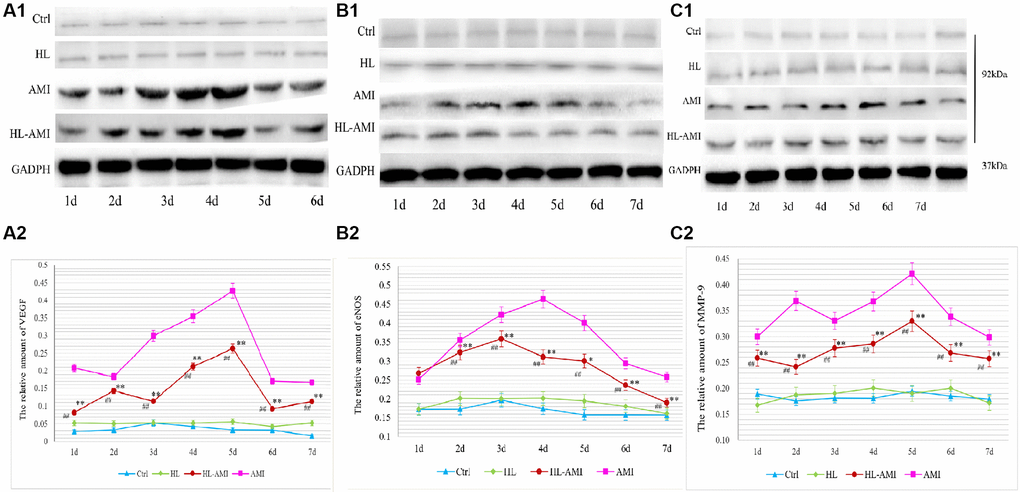 VEGF, eNOS, and MMP-9 expression in the myocardium of each group rats during 7 days after AMI. Western blot analysis of VEGF (A1), eNOS (B1), and MMP-9 (C1) protein expression in the myocardial tissue of the Ctrl, HL, AMI, and HL-AMI groups. GAPDH was used as the internal reference protein. (A2), (B2), and (C2) show the quantitative analysis of VEGF, eNOS, and MMP-9 respectively. *, **, P P #, ##, P P 