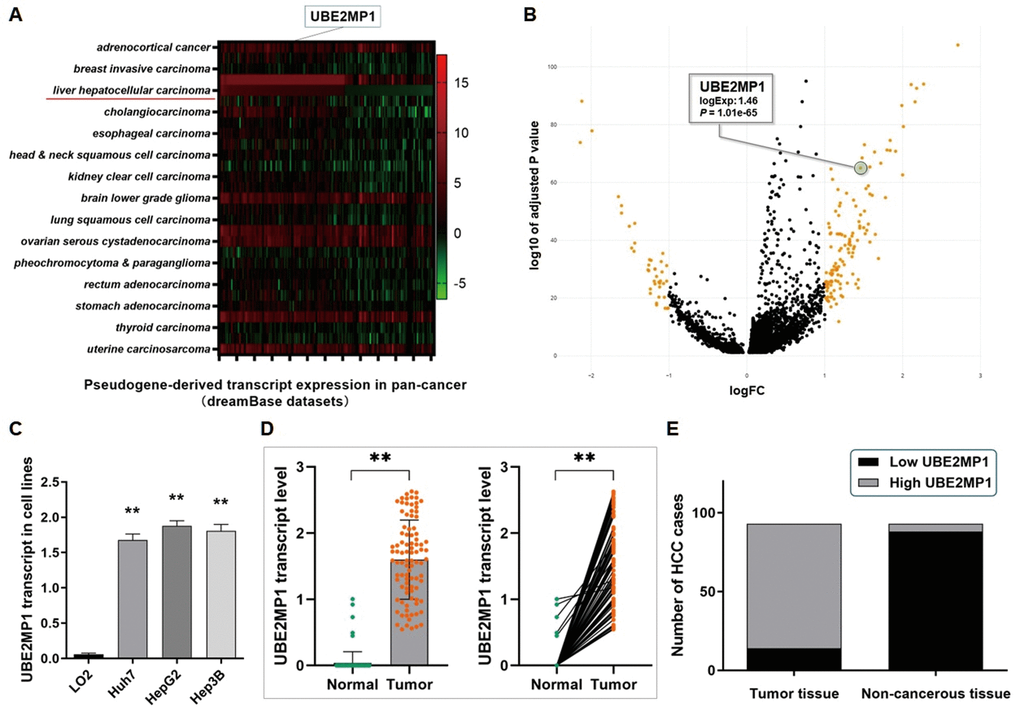 Pseudogene UBE2MP1 was anomalously transcripted in HCC cell lines and tissues. (A) Analysis of the dreamBase datasets. The heatmap indicated the expression profile of the transcript of UBE2MP1 in pan-cancer. (B) Analysis of the data from the LCLE. Pseudogene UBE2MP1 is transcriptionally activated and presents a high expression in HCC. (C) RT-qPCR assay demonstrated a significantly high expression of UBE2MP1 transcript in three HCC cell lines, in comparison with the control LO2 cells barely transcribed this pseudogene (**PD) RT-qPCR assay was conducted on 93 real patients’ specimens. The UBE2MP1 transcript was significantly highly expressed in tumor tissues, and only very few detectable UBE2MP1 transcript was found in the non-cancerous tissues (**PE) Statistic of the number of cases concerning the expression of UBE2MP1 transcript in HCC specimens. UBE2MP1 transcript is detectable and highly expressed in most of the tumor tissues (79/93), and was not detected in most of the adjacent non-cancerous tissues (88/93) (P