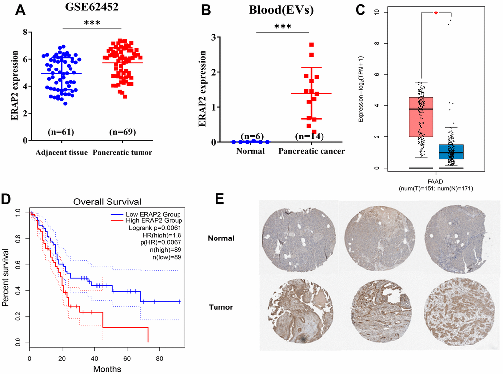 Expression and prognosis of ERAP2 in pancreatic cancer. (A) Expression of ERAP2 in GSE45452 chip pancreatic tumor and paracancerous tumor. (B) The expression of ERAP2 in extracellular vesicles of blood origin. (C) Expression of ERAP2 in the pancreatic cancer dataset from GEPIA database. (D) Kaplan-Meier survival curve of ERAP2 in pancreatic cancer data set from GEPIA database. (E) Immunohistochemical images of ERAP2 in pancreatic tissues and pancreatic tumors from ProteinAtlas database.