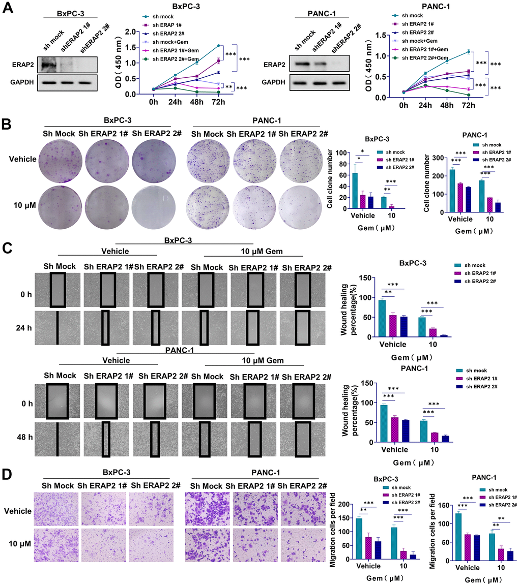 Effect of ERAP2 knockdown on tumorigenesis and gemcitabine sensitivity in pancreatic cancer cell lines. (A) Cell viability assay in two pancreatic cancer cell lines treated with ERAP2 knockdown, gemcitabine alone or gemcitabine with ERAP2 knockdown. (B) Cell proliferation assay in two pancreatic cancer cell lines treated with ERAP2 knockdown, gemcitabine alone or gemcitabine with ERAP2 knockdown. (C) Wound healing assay in two pancreatic cancer cell lines treated with ERAP2 knockdown, gemcitabine alone or gemcitabine with ERAP2 knockdown. (D) Transwell invasion assay in two pancreatic cancer cell lines treated with ERAP2 knockdown, gemcitabine alone or gemcitabine with ERAP2 knockdown. Data were shown as the mean ± SEM of three independent experiments (*p p p 