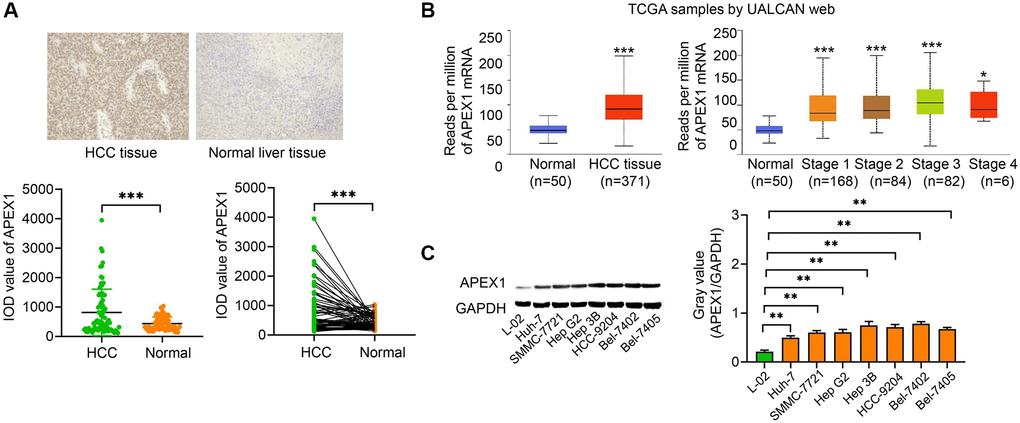 APEX1 is a novel HCC-related oncogene. (A) The expression of APEX1 was evaluated by immunohistochemistry analysis of HCC specimens and matched adjacent normal tissues (n = 80 cases). (B) Bioinformatics analysis using the UALCAN tool on TCGA dataset compared the mRNA expression of APEX1 in HCC (n = 371) and normal (n = 50) tissues (Left). The expression of APEX1 was also analyzed in HCC tissues at various stages (Right). (C) APEX1 protein expression was evaluated in HCC cells and normal hepatic cells by a Western blot assay. *P **P ***P 