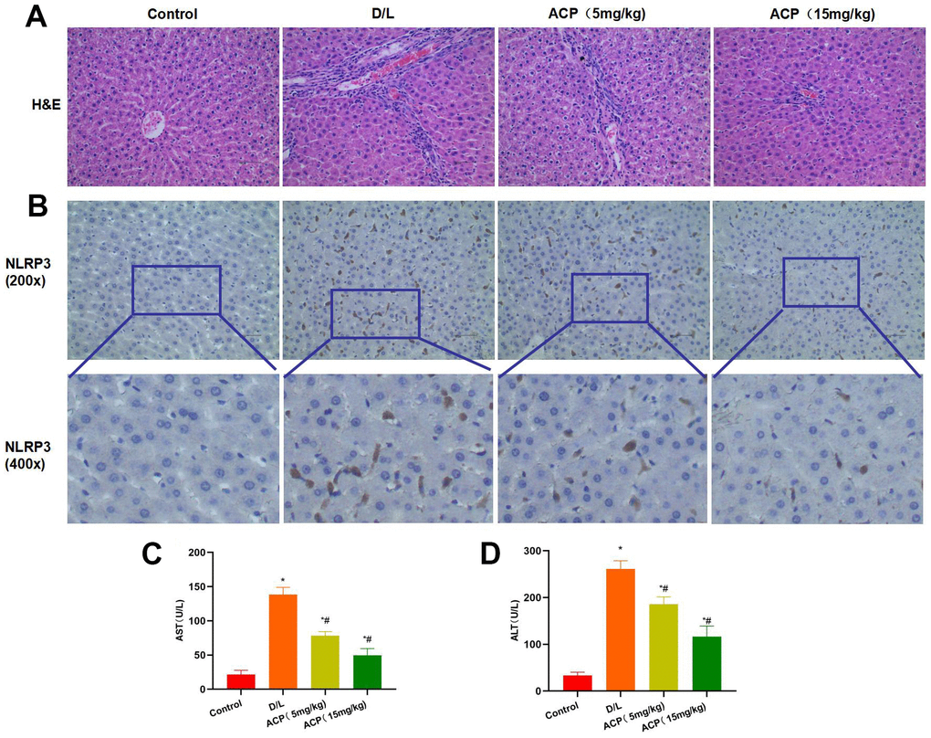 ACP suppressed liver injury in mice (n=5). (A) In H&E staining, obvious inflammatory response and injury were observed in liver tissues of D/L group, along with distinct bubble-like lesions, while ACP suppressed tissue inflammation and alleviated injury. (B) In NLRP3 staining, NLRP3 expression significantly increased in D/L group, while it was not expressed in Control group, demonstrating that liver injury led to NLRP3 activation. ACP dramatically reduced NLRP3 expression in tissues, and the difference was significant compared with D/L group. (C, D) In ALT and AST detection, ACP alleviated liver injury, and reduced ALT and AST expression in a dose-dependent manner. *P#P