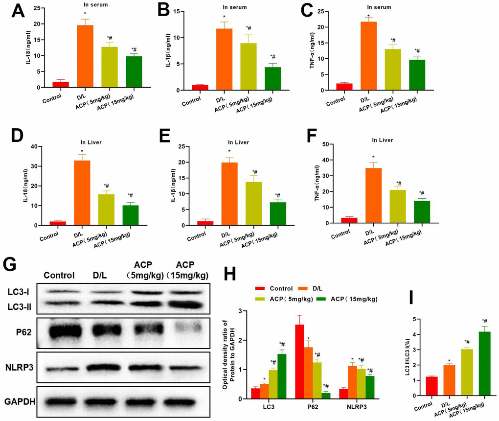 ACP suppressed inflammatory response and activated autophagy. (A–F) As discovered from serum and tissue inflammatory factor detection, the expression of serum and tissue inflammatory factors in D/L group increased, which was significantly higher than that of Control group. While ACP reduced the serum inflammatory factor levels in a dose-dependent manner. *P#PG–I) In protein detection, ACP promoted LC3 expression in tissues while suppressing NLRP3 expression, meanwhile, P62 expression also increased, and the LC3 II/LC3 I ratio increased in tissues. *P#P