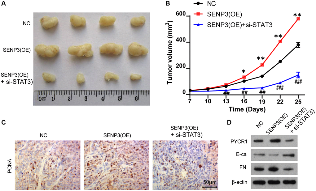 SENP3 promotes tumor proliferation by upregulating STAT3 in vivo. (A) A subcutaneous transplantation tumor model in nude BALB/c mice was established using the human bladder cancer cell line T24. The mice were divided into NC, SENP3(OE) and SENP3(OE) + si-STAT3 groups with 5 mice per group. (B) The growth curve of tumor volumes. [mean ± S.D. (error bars), n = 4. *p ≤ 0.05; **p ≤ 0.01, compared with NC group; ##p ≤ 0.01; ###p ≤ 0.001, compared with STAT3(OE) group, two-way analysis of variance]. (C) PCNA positive cells in subcutaneous transplantation tumor isolates by immunohistochemistry. [scale bar, 50 μm]. (D) PYCR1, E-ca and FN protein level of NC, SENP3(OE) and SENP3(OE) + si-STAT3 mice transplantation tumor.