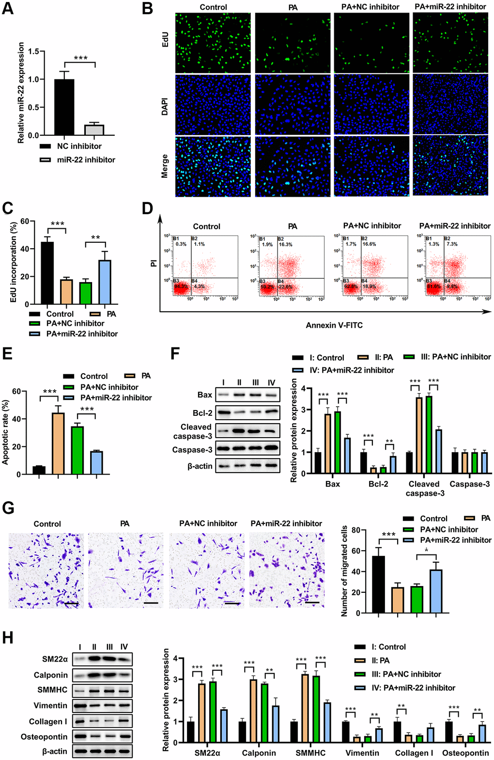 miR-22 inhibitor abolished the effects of PA on VSMC phenotype switch. (A) MiR-22 inhibitor decreased the miR-22 levels in VSMCs. (B, C) The proliferation of VSMCs transfected with miR-22 inhibitor or/and 200 μM PA. (D, E) The apoptosis of VSMCs transfected with miR-22 inhibitor or/and 200 μM PA. (F) The expression of apoptosis associated markers in VSMCs transfected with miR-22 inhibitor or/and 200 μM PA. (G) The migration of VSMCs transfected with miR-22 inhibitor or/and 200 μM PA determined by transwell assay. Scale bar=100 μm. (H) Western blot analyses showing that expression of SM22α, calponin, SMMHC, vimentin, collagen I, and osteopontin in PA-treated VSMCs transfected with miR-22 inhibitor. n = 3. *P **P 