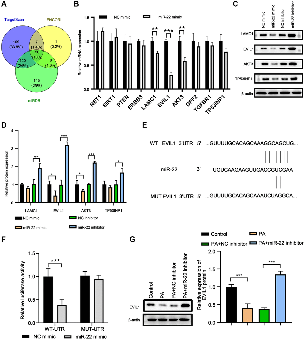 EVI1 was the target of miR-22. (A) Target genes of miR-22 were predicted by miRDB, TargetScan and ENCORI. (B) MRNA levels of target genes in VSMCs treated with miR-22 mimics. (C, D) Protein levels of SM22α, calponin, SMMHC, vimentin, collagen I, and osteopontin in VSMCs detected by western blot. (E) The complementary sequence between 3′-UTR of EVIL1 and miR-22. (F) Dual-luciferase reporter assay. (G) EVI1 protein level was detected by western blot in VSMCs treated with miR-22 inhibitor or PA. n = 3. *P **P 