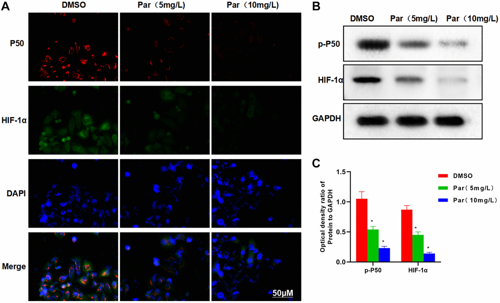 Par inhibits the metastatic, invasive and glycolytic abilities of H22 cells. (A) IFA revealed high expression levels of P50 and HIF-1α in H22 cells, with strong fluorescence intensities. Par could suppress the P50 and HIF-1α expressions, as manifested by the significantly weakened fluorescence intensity in the Par group. (B, C) Protein assay demonstrated that Par inhibited the p-P50 and HIF-1α expressions in a dose-dependent manner. *P 