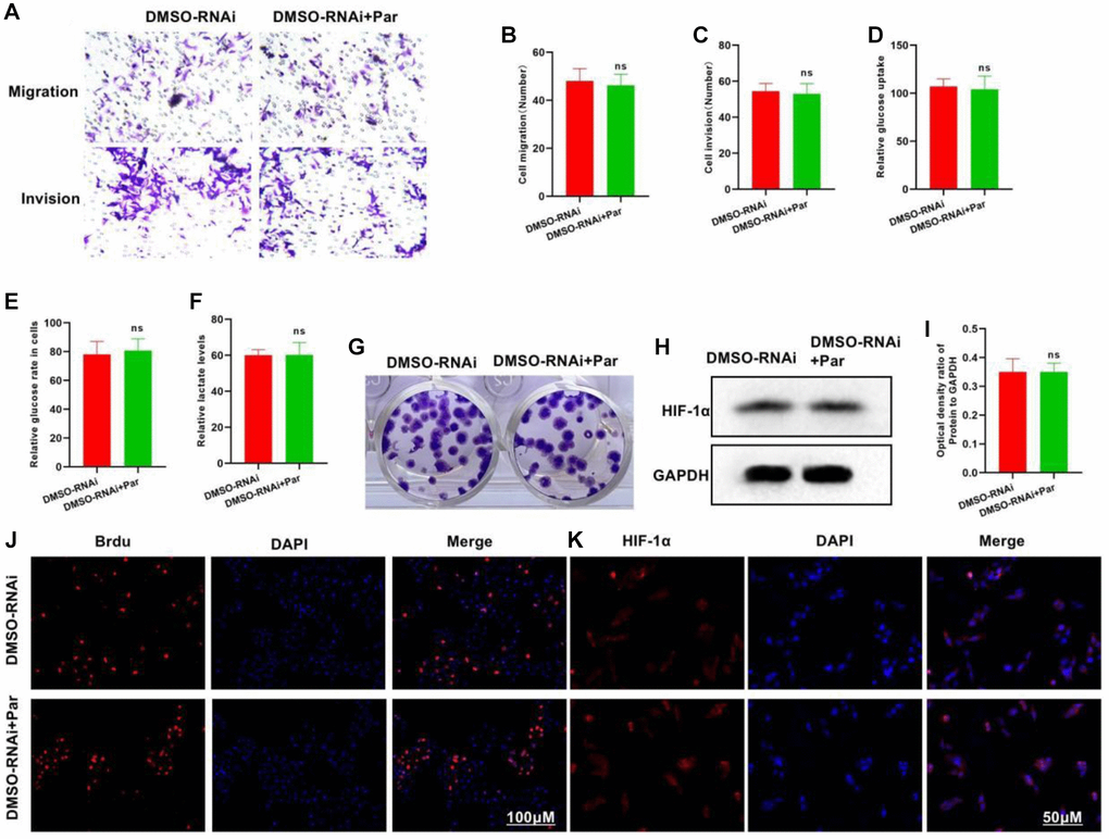 Silencing P50 inhibits the effect of Par. (A–C) DMSO-RNAi+Par group differed insignificantly from DMSO-RNAi group regarding the numbers of invasive and metastatic cells. nsP > 0.05 vs. DMSO-RNAi group. (D–F) In the glycolysis assay, the glucose uptake, intracellular glucose level and lactate expression of the DMSO-RNAi+Par group differed insignificantly from those of the DMSO-RNAi group. nsP > 0.05 vs. DMSO-RNAi group. (G) Insignificant difference in the number of plate clones was noted between the DMSO-RNAi+Par and the DMSO-RNAi groups. (H, I) After P50 silencing, Par exerted an insignificant effect on the HIF-1α expression. nsP > 0.05 vs. DMSO-RNAi group. (J, K) Difference in the Brdu-positive cell count was insignificant between the DMSO-RNAi+Par and the DMSO-RNAi groups.