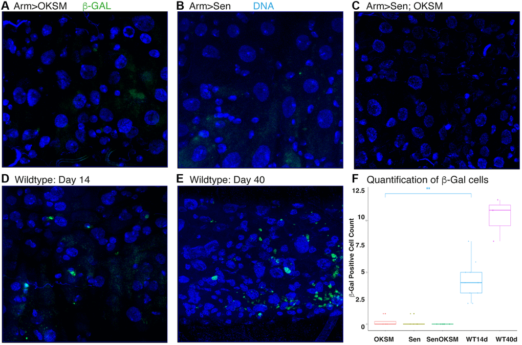 Expression of OKSM, Sen and OKSM-Sen led to decreased SA-β-gal expression. Levels of b-galactosidase were assessed at day 40 in the following ubiquitous expression experiments using armGal4; tubGal80ts to drive the expression of UAS-OKSM (A), UAS-Sen (B), combination of UAS-Sen and UAS-OKSM (C), and the control UAS-TdTomato at both day 14 (D) and day 40 (E). (F) Results were quantified from five experiments.
