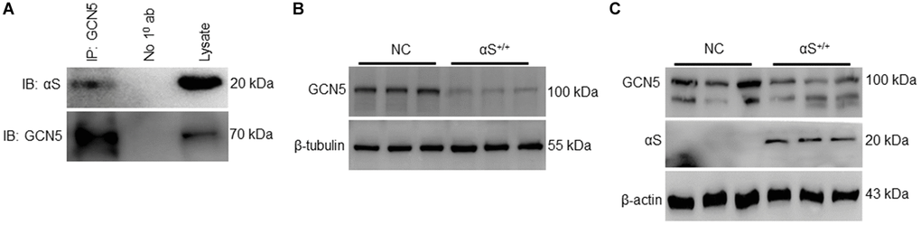 αS+/+ inhibiting endogenous GCN5 and inhibiting GCN5 expression. (A) co-immunoprecipitation of GCN5 in wildtype SH-SY5Y and probed for anti-αS. Endogenous protein expression of GCN5 in neuronal SH-SY5Y cells (B) and non-neuronal HEK293T cells (C) transfected (αS) or NC.