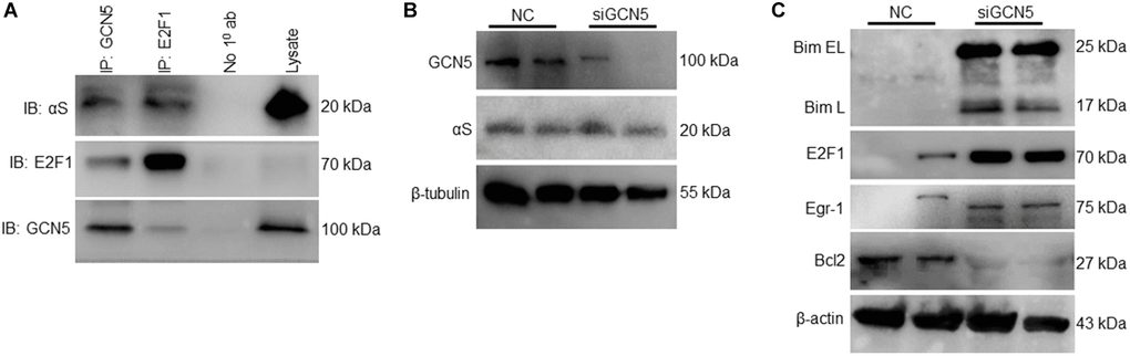 Inhibition of GCN5 by αS triggering Bim expression. (A) Co-immunoprecipitation of GCN5 and E2F1 in neuronal SH-SY5Y cells and probed for anti-αS. (B) GCN5 siRNA was used to knockdown GCN5 in SH-SY5Y cells; protein lysates were collected 24 h after siGCN5 induction and probed for anti-GCN5 and anti-αS. (C) Protein expression of apoptotic and anti-apoptotic markers.