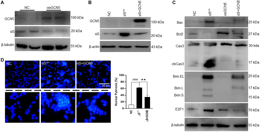 Co-overexpression of αS-GCN5 inhibits apoptotic neuronal cell death. (A) Endogenous protein expression of αS in GCN5 overexpressed (oeGCN5) or NC cells. (B) Protein was isolated from NC, αS+/+ and αS+GCN5 cells and probed for specific proteins. (C) Protein expression of apoptotic markers using lysates from NC, αS+/+, oeGCN5 and αS+GCN5 cells. (D) Nucleic staining by DAPI where the whitish inclusions (cropped) indicated apoptotic cells with nuclear pyknosis; the pyknosis rate (% chromatin aggregation) was calculated by the scoring percent of cells with nuclear pyknosis in total DAPI-stained cells (scale bar = 40 μm). ###p +/+ and **p +/+ vs. αS+GCN5.