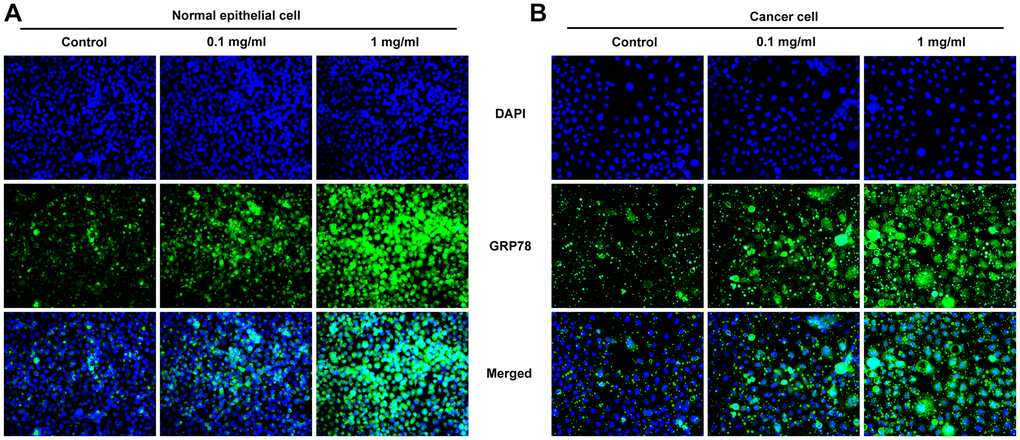 Pepsin increased the expression of GRP78 in laryngeal epithelial cells and LC cells. (A and B) IF assay was used to detect the expression of ERS-related protein GRP78 in laryngeal epithelial cells and LC cells. *p **p ***p 