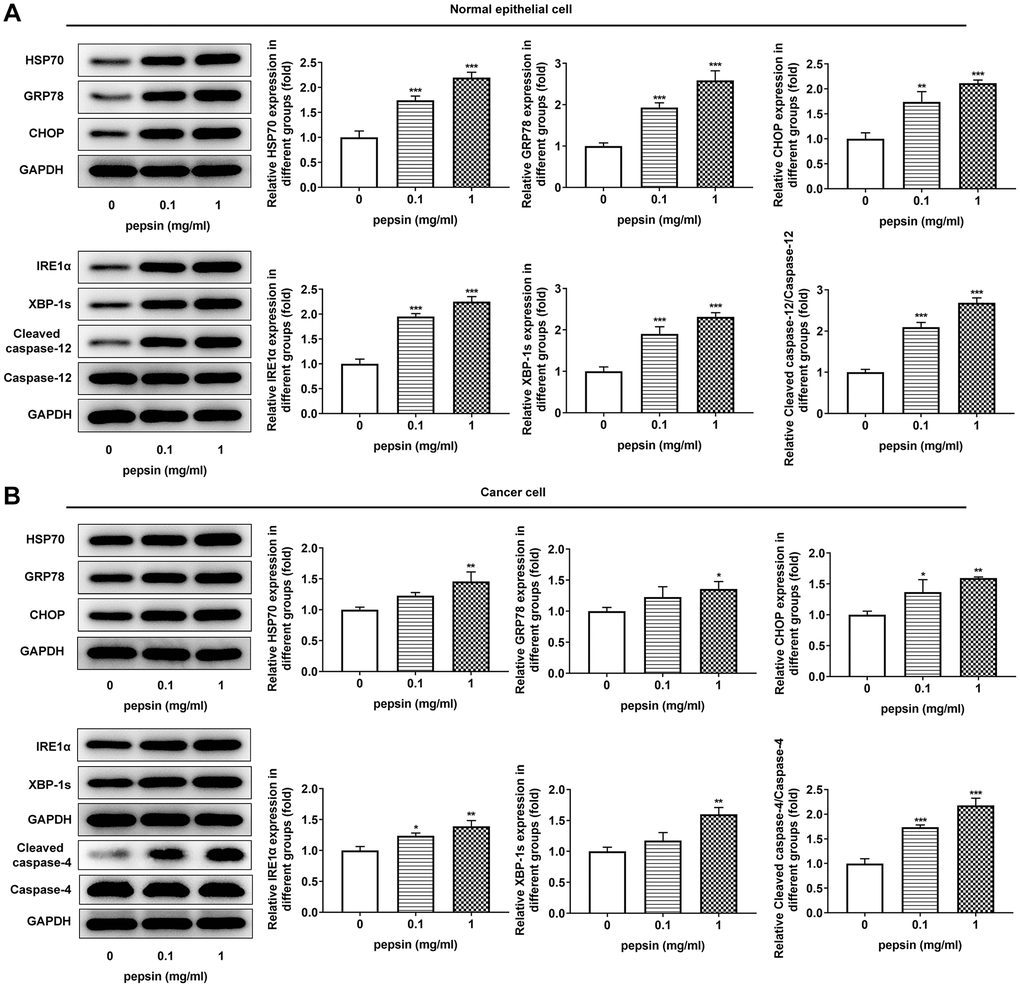 Pepsin enhanced the expression of HSP70 and ERS-related proteins in laryngeal epithelial cells and LC cells. (A and B) Western blot detected the expression of ERS-related proteins in laryngeal epithelial cells and LC cells. *p **p ***p 