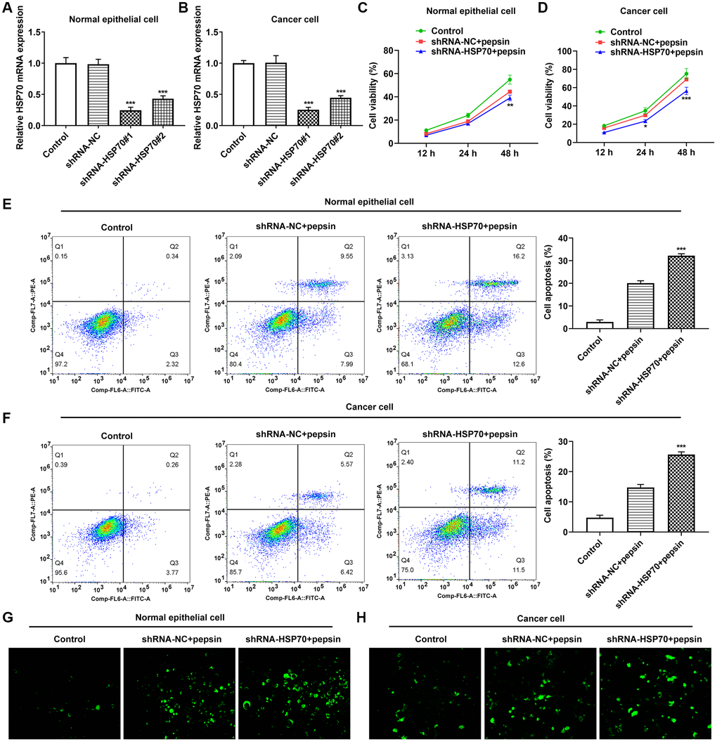 The effect of inhibition of HSP70 on cell viability, apoptosis and autophagy. (A and B) RT-qPCR detected the expression of HSP70 in laryngeal epithelial cells and LC cells. ***p C and D) CCK8 detected the viability in laryngeal epithelial cells and LC cells. (E and F) Apoptosis of laryngeal epithelial cells and LC cells were detected by flow cytometry. (G and H) The autophagy detection kit measured autophagy levels in laryngeal epithelial cells and LC cells. **p ***p 