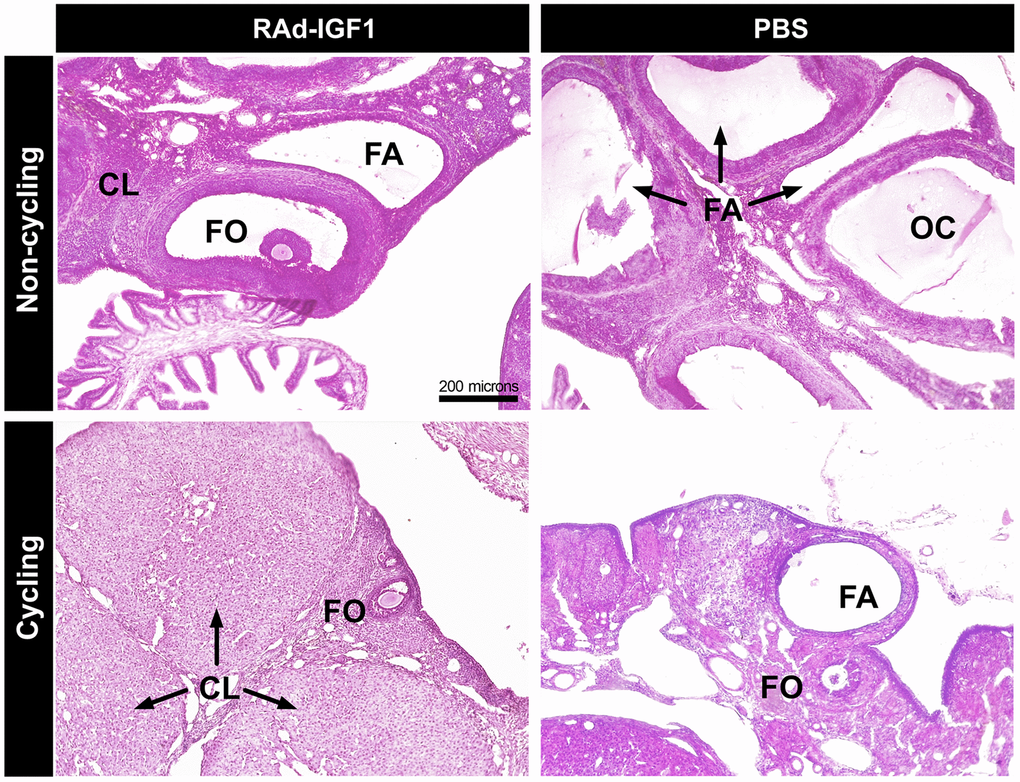 Histology of representative ovaries from control (PBS) and experimental (RAd-IGF1) 12-months-old MA Sprague Dawley rats. Ovarian sections from non-cycling (above) and cycling rats (below). Abbreviations: CL: corpora lutea; FA: atretic follicles; FO: ovarian follicles; OC: ovarian cysts. Total magnification of 100× (scale bar: 200 microns).