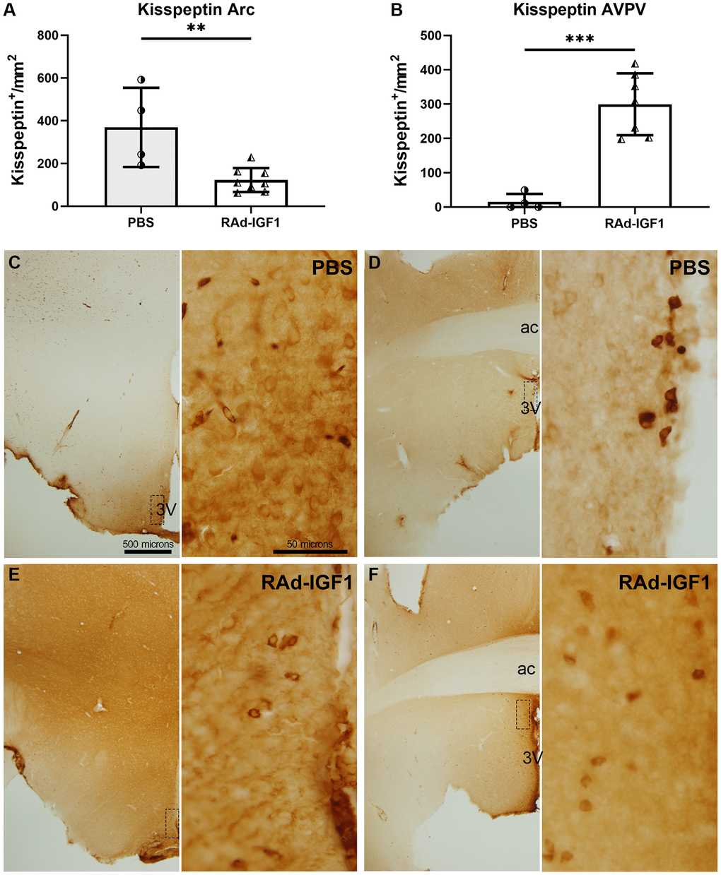 IGF1 gene therapy effect on the kisspeptin immunopositive cells. (A and B) Quantification of kisspeptin immunopositive cells. Error bars represent SD (NRAd-IGF1 = 7; NPBS = 4). Two-tailed t-test was used. Asterisks indicate significant (**p ***p Figure 5A post hoc power (1-β) analysis: 0.7533; Figure 5B post hoc power (1-β) analysis: 0.9999. (C–F) Immunohistochemistry for kisspeptin of control (PBS) and experimental (RAd-IGF1) rat’s brain slides at a magnification of 40× (scale bar: 500 microns), with insets at a magnification of 600× (scale bar: 50 microns). 3V: third ventricle; ac: anterior commissure.