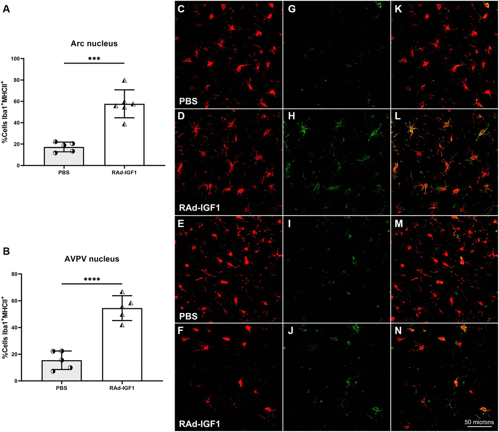 IGF1 gene therapy effect on the activation state of microglia. (A and B) Percentage of microglia presenting double immunostaining for Iba1 and MHCII. Error bars represent SD (Arcuate: NRAd-IGF1 = 6; NPBS = 5. AVPV: NRAd-IGF1 = 5; NPBS = 5). Two-tailed t-test was used. Asterisks indicate significant (***p ****p C–F), MHCII cells (G–J) and colocalization of both markers (K–N) (Total magnification of 200×; scale bars: 50 microns). Figure 7A post hoc power (1-β) analysis: 0.99997; Figure 7B post hoc power (1-β) analysis: 0.999997.