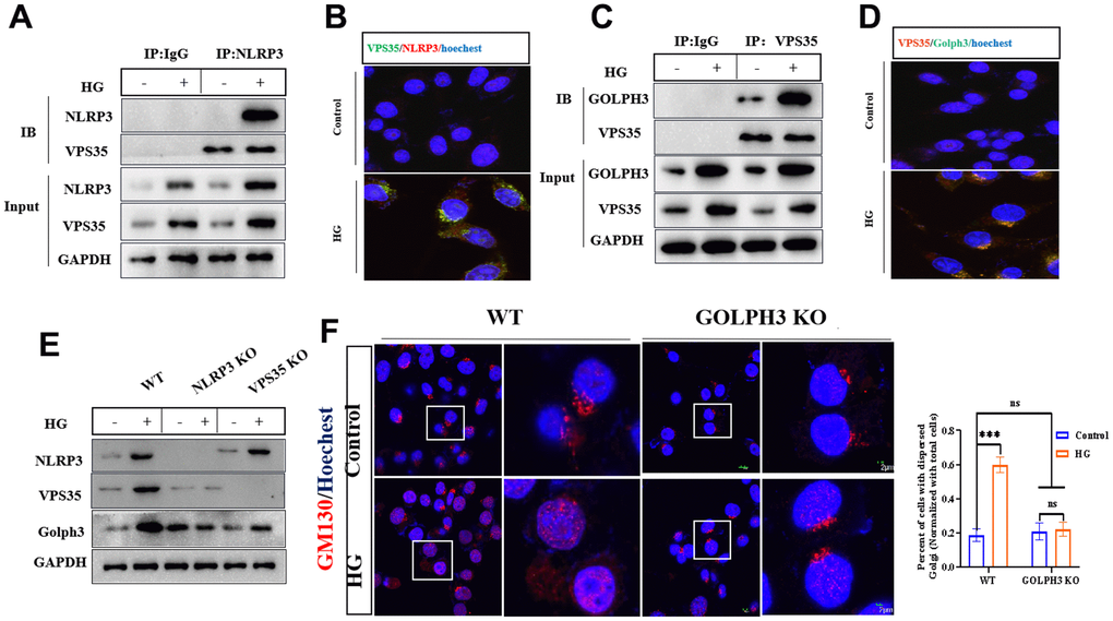 HG promotes the activation of NLRP3/VPS35/Golph3 pathway. (A) The interaction of NLRP3 and VPS35 was determined by co-immunoprecipitation experiment. Lysates from BV2 microglial cells were immunoprecipitated with a NLRP3 antibody or rabbit IgG and immunoblotted with VPS35 and NLRP3 antibody. (B) The colocalization of NLRP3 and VPS35 was tested by immunofluorescence method. Bar = 2 μm. (C) The interaction of VPS35 and Golph3 was determined by co-immunoprecipitation experiment. Lysates from BV2 microglial cells were immunoprecipitated with a VPS35 antibody or rabbit IgG and immunoblotted with VPS35 and Golph3 antibody. (D) The colocalization of VPS35 and Golph3 was tested by immunofluorescence method. Bar = 2 μm. (E) Western blot analysis of NLRP3, VPS35, and Golph3 in WT, NLRP KO and VPS35 KO BV2 cells treated with or without HG. GAPDH was used as an internal control for normalization. (F) Immunofluorescence detection of GM130 in WT and Golph3 KO BV2 cells, the percent of cells with dispersed Golgi apparatus normalized with total cells. Bar = 2 μm. Data represent means ± SEM of 3 independent experiments. * p ≤ 0.05, ** p ≤ 0.01, and *** p ≤ 0.001 according to two-way ANOVA with Bonferroni's post hoc test.
