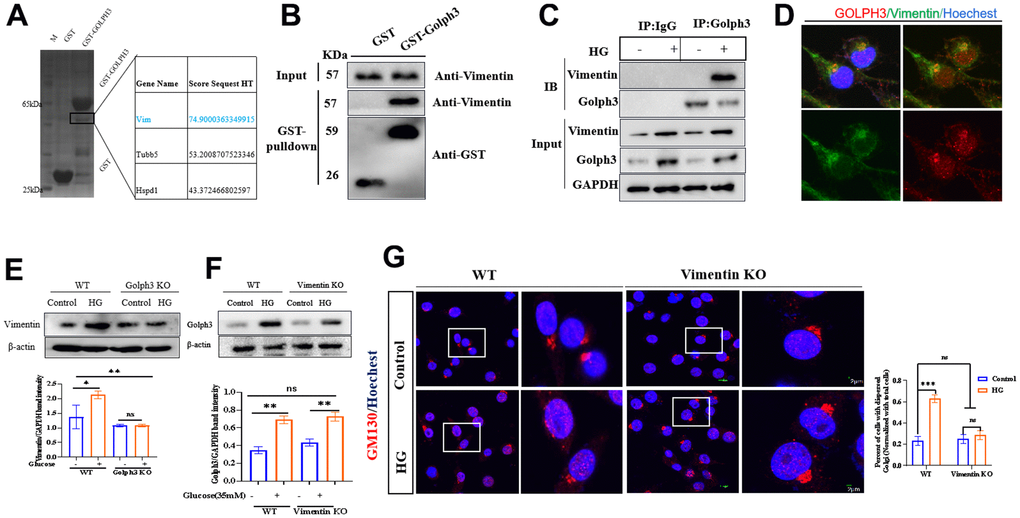 Golph3 regulates GA stress by interacting with vimentin. GST-Golph3 protein was expressed and purified from the Escherichia coli expression system, and cell lysates were precipitated with glutathione Sepharose beads and immunoblotted by SDS-PAGE, the obviously precipitated proteins in the SDS gel were tested by mass spectrometry (A) and immunoblotted with Vimentin antibody (B). (C) Lysates from BV2 microglial cells were immunoprecipitated with a Golph3 antibody or rabbit IgG and immunoblotted with a mouse vimentin antibody. (D) The colocalization of NLRP3 and VPS35 was tested by immunofluorescence method. Bar = 2 μm. (E) Western blot analysis of Vimentin in WT, Golph3 KO BV2 cells treated with or without HG. GAPDH was used as an internal control for normalization. (F) Western blot analysis of Golph3 in WT, Vimentin KO BV2 cells treated with or without HG. GAPDH was used as an internal control for normalization. (G) Immunofluorescence detection of GM130 in WT and Vimentin KO BV2 cells, the percent of cells with dispersed Golgi apparatus normalized with total cells. Bar = 2 μm. Data represent means ± SEM of 3 independent experiments. * p ≤ 0.05, ** p ≤ 0.01, and *** p ≤ 0.001 according to two-way ANOVA with Bonferroni's post hoc test.