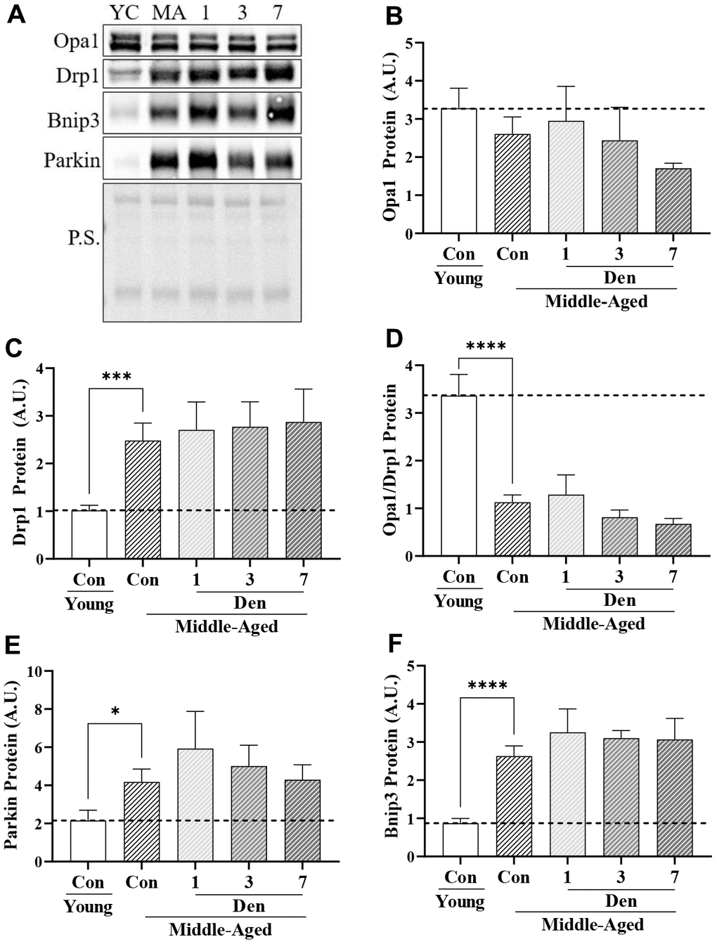 Proteins related to mitochondrial dynamics and mitophagy in young and middle-aged control and denervated skeletal muscle. (A) Representative western blots for Opa1, Drp1, Bnip3 and Parkin proteins in skeletal muscle samples. Quantification of (B) Opa1 protein; (C) Drp1 protein; (D) Opa1/Drp1 protein; (E) Parkin protein; and (F) Bnip3 protein. *p