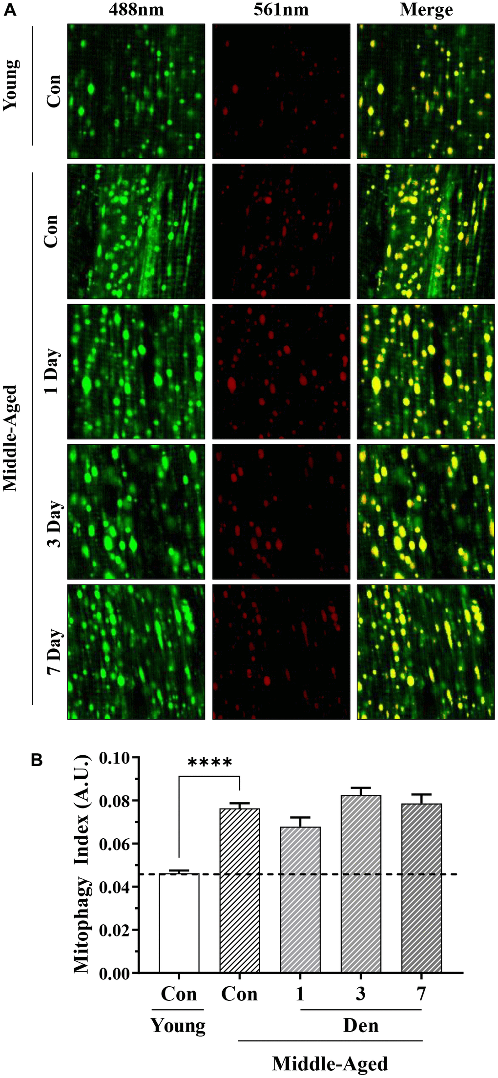 Assessment of mitophagy flux by mt-Keima fluorescence in young and middle-aged control and denervated skeletal muscle. (A) Representative fluorescence images from the TA muscle of mt-Keima in green (ex. 488nm; mitochondria), red (ex. 561nm; mitolysosomes), and merged. (B) Mitophagy index as calculated by red/total red+green fluorescence. ****p