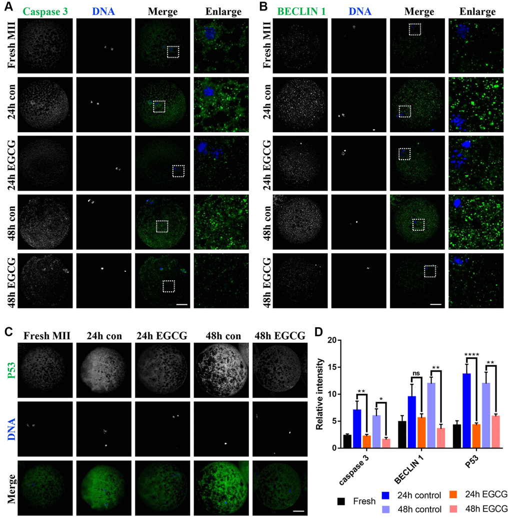 Epigallocatechin-3-gallate (EGCG) rescues apoptosis and autophagy induced by oocyte aging. (A) Active-caspase 3 expression was analyzed by immunofluorescence in the Fresh, 24 h control, 24 h EGCG, 48 h control, and 48 h EGCG oocytes. (B) Beclin 1 level was analyzed by immunofluorescence in the Fresh, 24 h control, 24 h EGCG, 48 h control, and 48 h EGCG oocytes. (C) P53 expression was analyzed by immunofluorescence in the Fresh, 24 h control, 24 h EGCG, 48 h control, and 48 h EGCG oocytes. (D) Relative intensities of caspase 3, Beclin 1, and P53 in the Fresh, 24 h control, 24 h EGCG, 48 h control, and 48 h EGCG oocytes. Scale bars represent 20 μm. *p **p 