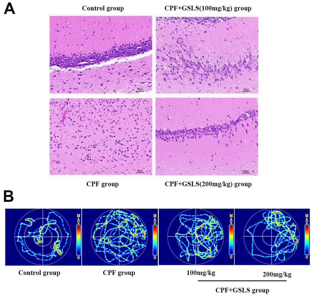 (A) HE staining of pathological changes in mouse hippocampi (magnification: 400 ×, n = 10 in each group). (B) Thermal infrared track diagram of mouse moving in Morris water maze.