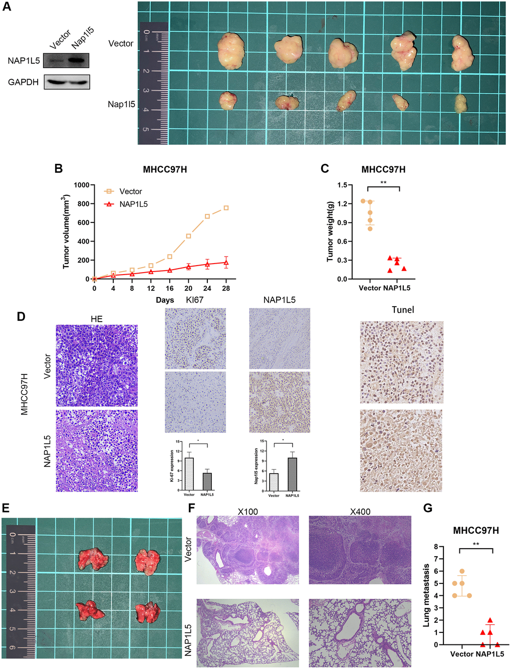 NAP1L5 inhibits tumor growth and metastasis in vivo. (A–C) Xenografted tumors were produced by injection of MHCC97H cells overexpressing NAP1L5 (experimental group) or carrying control vector (control group). The growth of the transplanted tumor was measured by volume and weight. (D) HE, IHC, Ki-67 and TUNEL staining were performed on the transplanted tumor. (E) The lung metastasis model was established by injecting MHCC97H cells overexpressing NAP1L5 (experimental group) or control vector (control group) through the tail vein. (F, G)The number of metastatic foci in lung tissue was observed, and HE staining was performed on lung tissue. *p **p ***p 