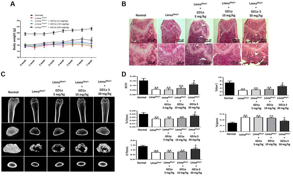 Analysis of trabecular and cortical bone of the femur. LmnaDhe/+ mutant mice were intraperitoneally injected with ganglioside GD1a at 5, 10, and 30 mg/kg/2-day for 7 weeks. (A) The mice were weighed once a week for 7 weeks, and (B) Hematoxylin and eosin staining of the femur nearby the metaphysic area. (C) Micro-CT analysis of trabecular and cortical bone of femur. (D) Representative parameters of trabecular and cortical bone, respectively. *p **p #p LmnaDhe/+ mutant mouse.