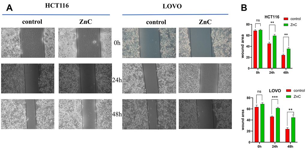 ZnC inhibited the migration in CRC. (A) Wound healing assays were used to assess cell migration of CRC cells treated by ZnC. (B) Results of the cell migration count analysis. **p p 