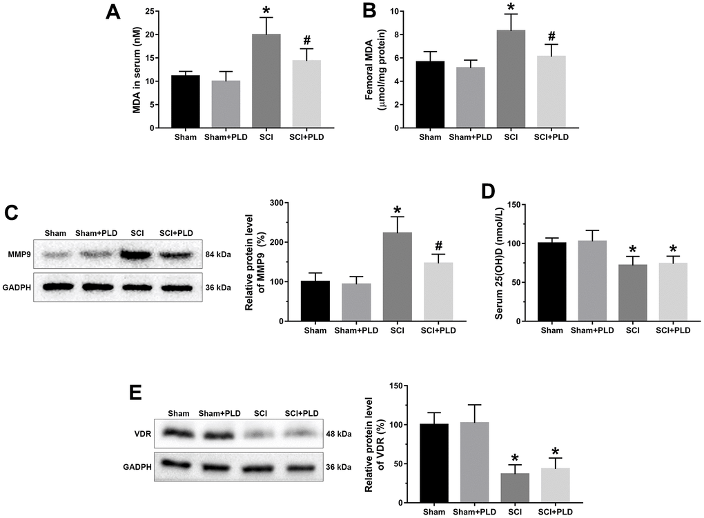 Effects of treatment with PLD on oxidative stress and vitamin D deficiency in serum and femurs of mice. MDA levels in serum (A) and femurs (B) were determined using a kit. (C) The expression level of MMP-9 in femoral tissues was detected by immunoblot. (D) Serum 25(OH)D levels were determined by radioimmune assay. (E) Femoral protein expression of VDR were determined by Western blotting and quantification analysis were shown. The protein levels of MMP-9 and VDR were adjusted as relative values to GAPDH. Data are expressed as mean ± S.D.; n=5 to 7 per group; *P P 